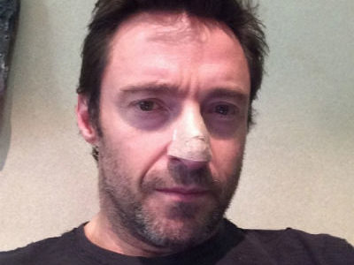 Hugh Jackman